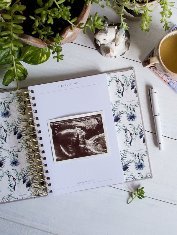 Bump. My Pregnancy Journal. Boxed