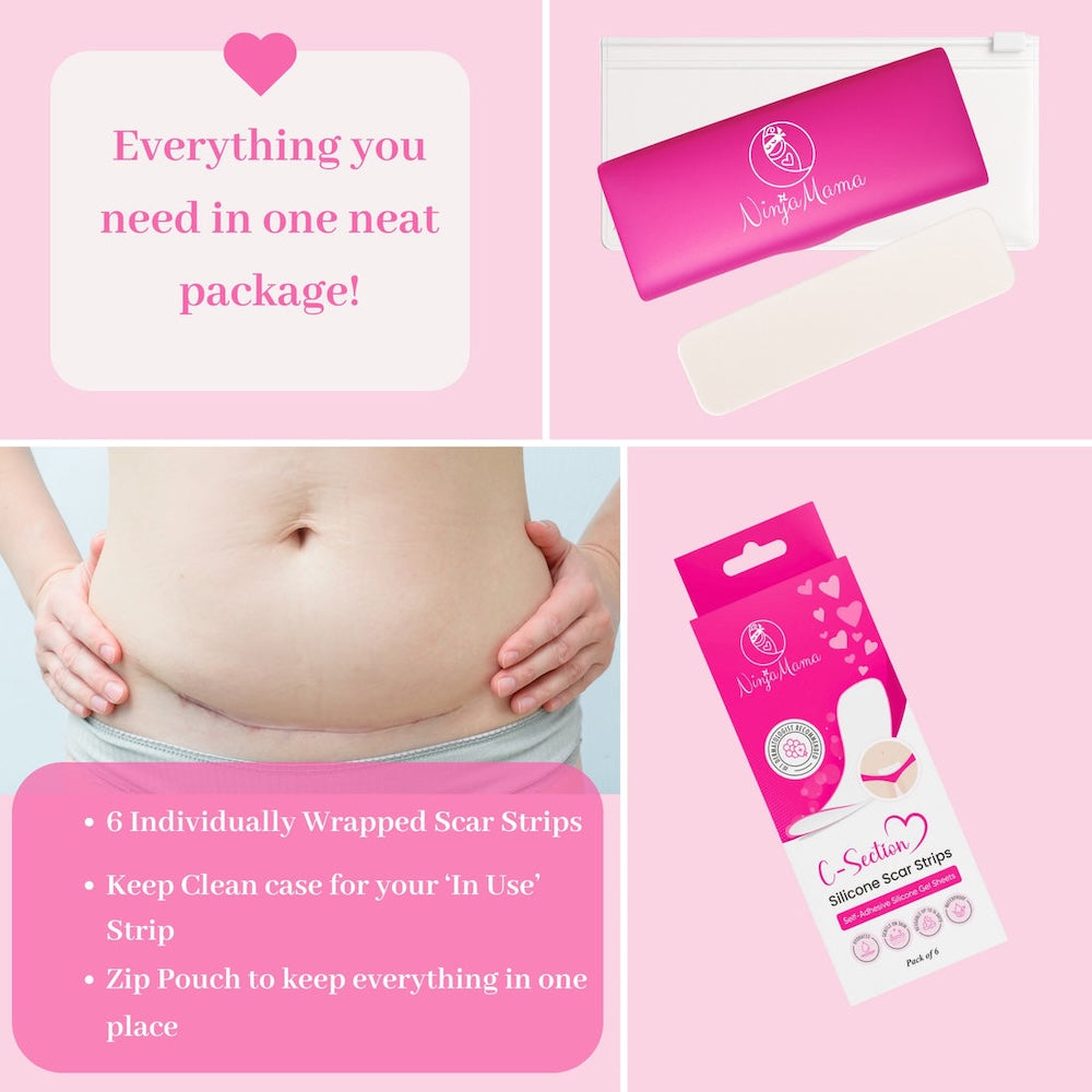 C-Section Silicone Scar Strips