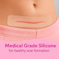 C-Section Silicone Scar Strips