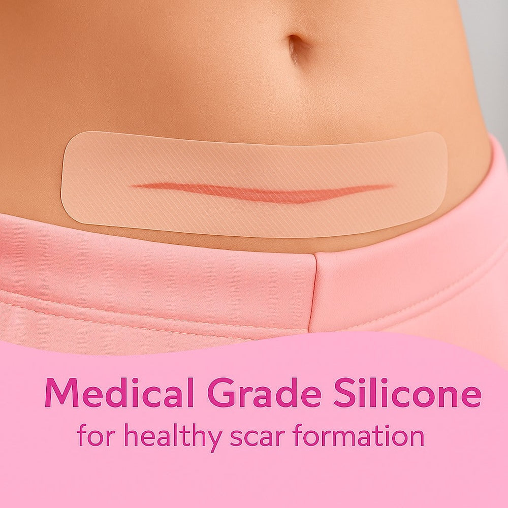C-Section Silicone Scar Strips